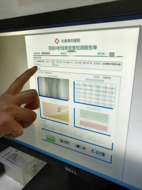 品源雙能X射線骨密度儀落戶吉林省長春骨傷醫(yī)院，助力骨松診療