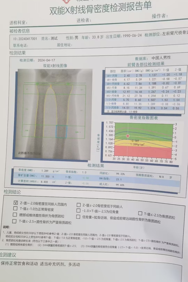 雙能X射線骨密度儀：準(zhǔn)確測量骨密度，助力骨質(zhì)疏松防治，守護(hù)骨骼健康